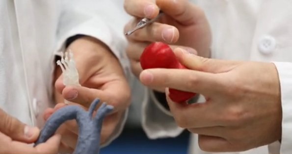 چاپ سهبعدی غضروف برای ترمیم نای چاپ سهبعدی غضروف برای ترمیم نای