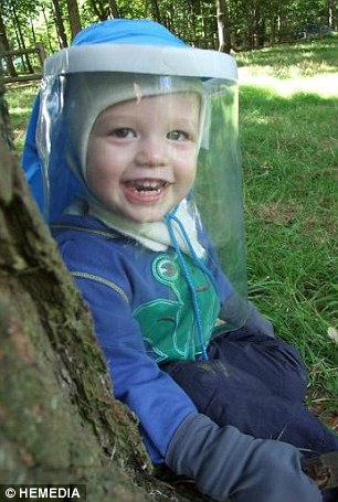 پسری که از نور خورشید سرطان می‌گیرد (+عکس)