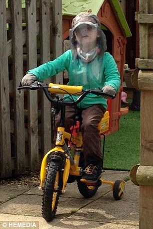 پسری که از نور خورشید سرطان می‌گیرد (+عکس)