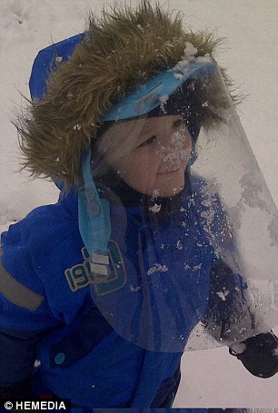 پسری که از نور خورشید سرطان می‌گیرد (+عکس)