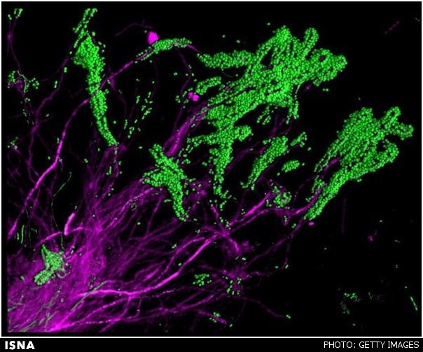 تصاویر رنگارنگ از میکروبهای دندان تصاویر رنگارنگ از میکروبهای دندان