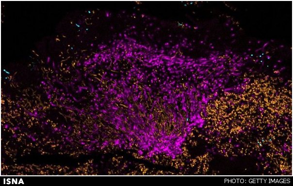تصاویر رنگارنگ از میکروبهای دندان تصاویر رنگارنگ از میکروبهای دندان