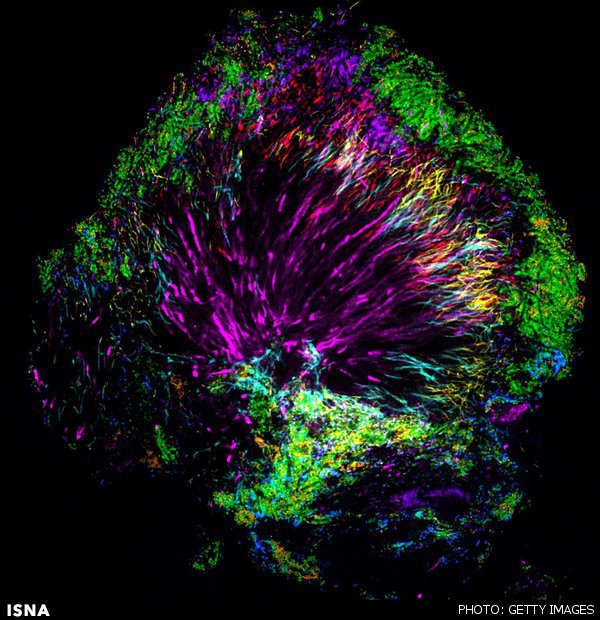 تصاویر رنگارنگ از میکروبهای دندان تصاویر رنگارنگ از میکروبهای دندان