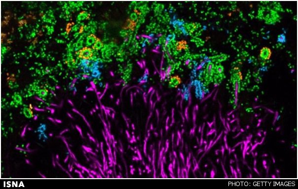 تصاویر رنگارنگ از میکروبهای دندان تصاویر رنگارنگ از میکروبهای دندان