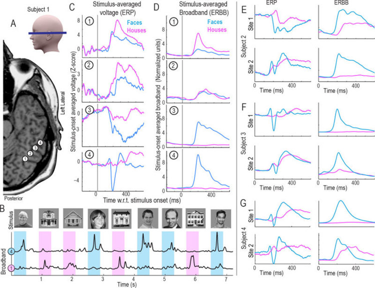 تکنیکی جدید برای خواندن ذهن انسان با سرعت بالا
