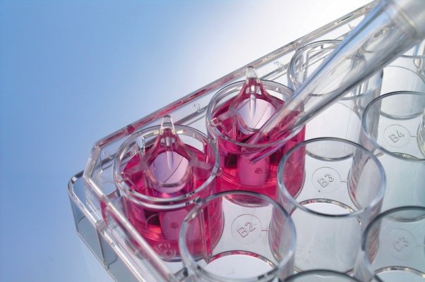 روشی برای نگهداری سلولهای بنیادی ابداع شد روشی برای نگهداری سلولهای بنیادی ابداع شد