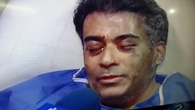 متهمان اسیدپاشی تهران در آستانه آزادی