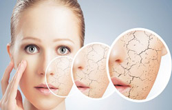 توصیه های غذایی برای پوست های مختلف