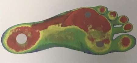 کفی الکتریکی برای اصلاح خودآگاهانه راه رفتن کفی الکتریکی برای اصلاح خودآگاهانه راه رفتن