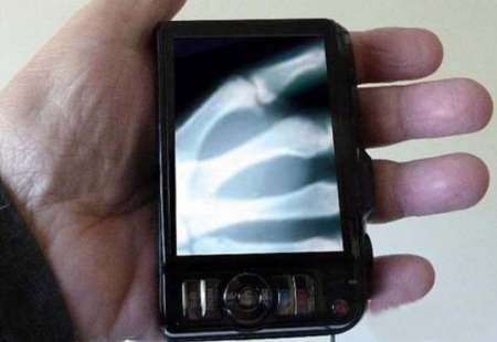 اختراع رادار هوشمند در چین اختراع رادار هوشمند در چین