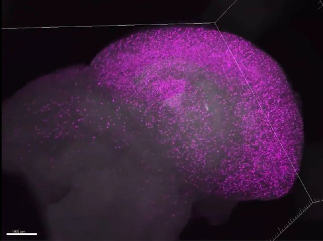 کشف منشا آلزایمر با فناوری تصویربرداری جدید کشف منشا آلزایمر با فناوری تصویربرداری جدید