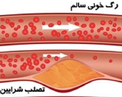 نشانه ها را جدی بگیریم