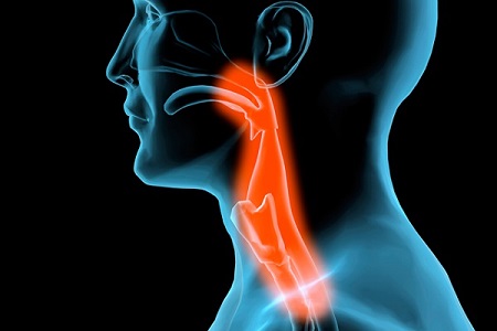 کلینیک سرطان عصر ایران