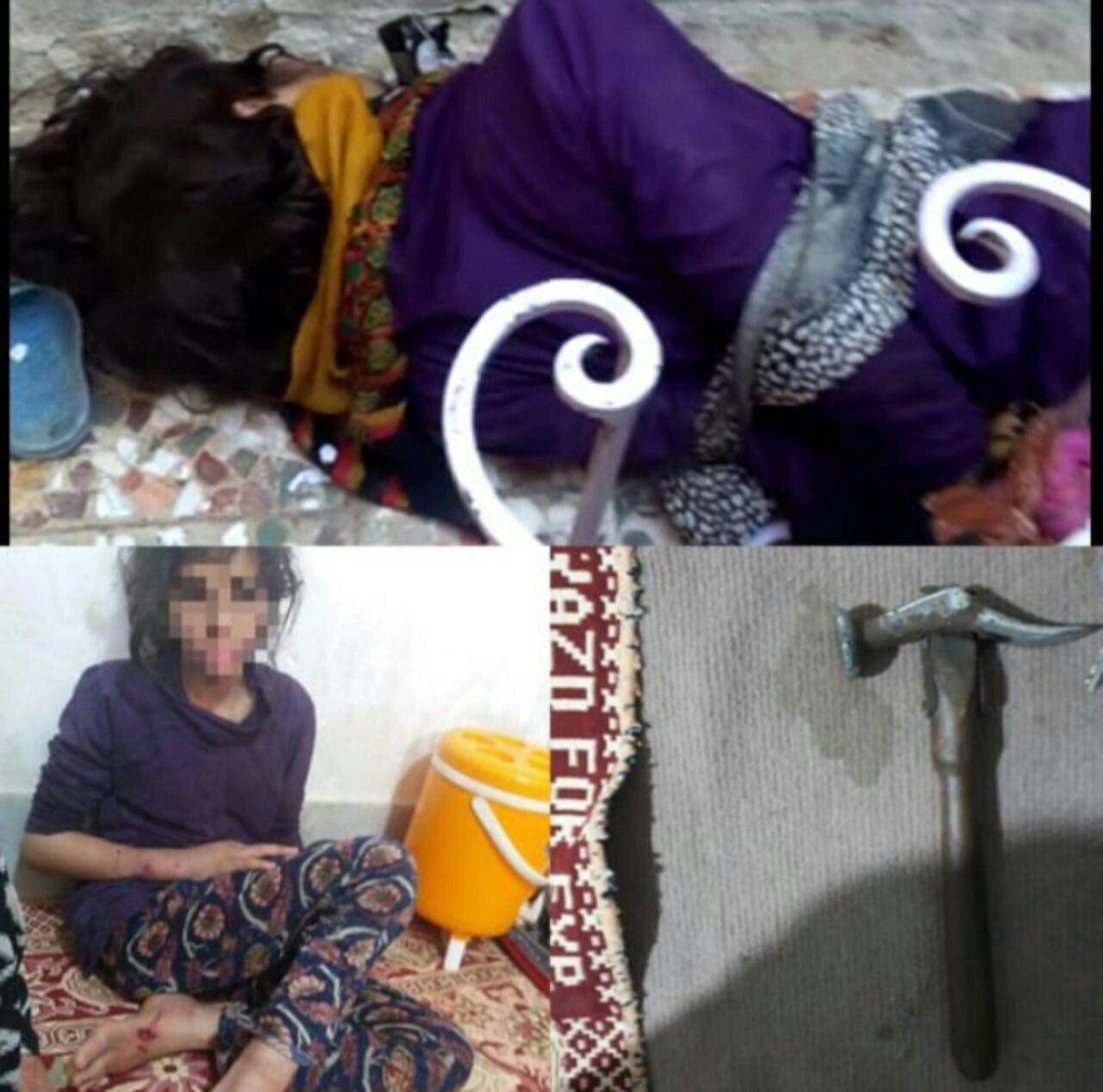 کودک‌آزاری در بندر ماهشهر/ ضرب و شتم فرزندان با چکش