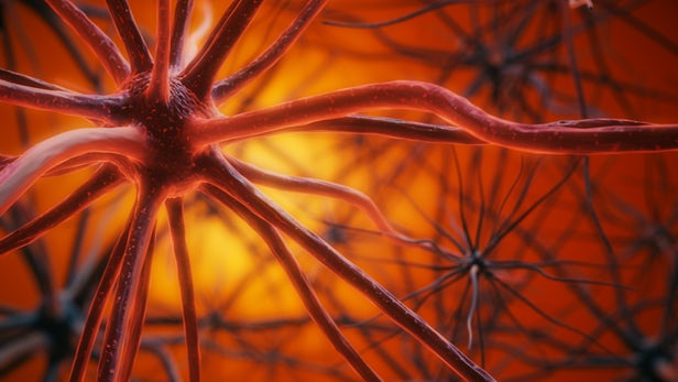 چرا پلاک‌های آلزایمر همواره به زوال عقل منجر نمی‌شوند؟