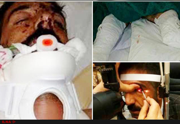 کولبر قربانی مین هیچ بیمه‌ای ندارد/ کلیه‌هایم را می فروشم تا هزینه عمل چشمم را جور کنم