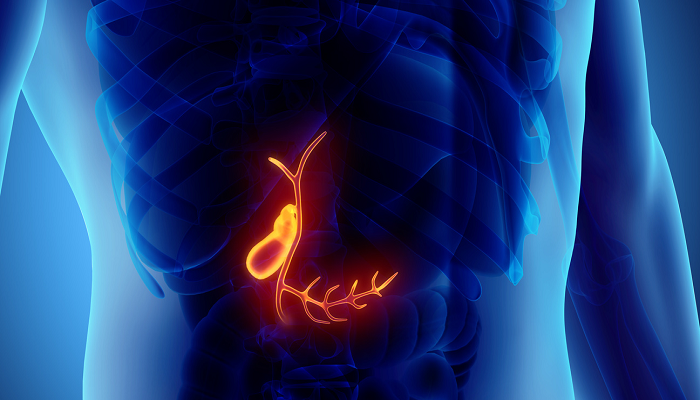 وقتی کیسه صفرا حمله میکند! وقتی کیسه صفرا حمله میکند!