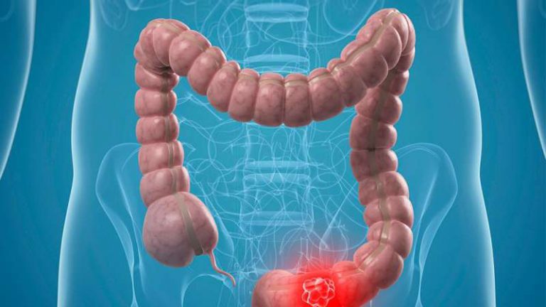 یبوست یبوست