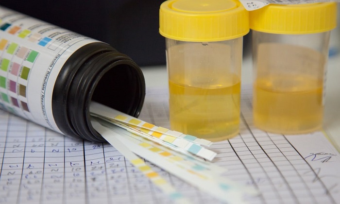 آلبومینوریا؛ وقتی پروتئین در ادرار نشت می‌کند