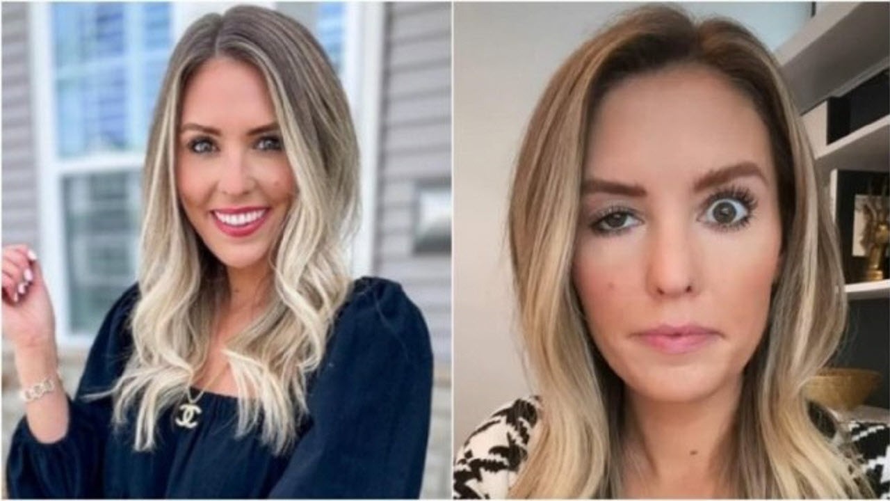 بلایی که بوتاکس بر سر یک اینفلوئنسر اینستاگرام آورد (+عکس) بلایی که بوتاکس بر سر یک اینفلوئنسر اینستاگرام آورد (+عکس)