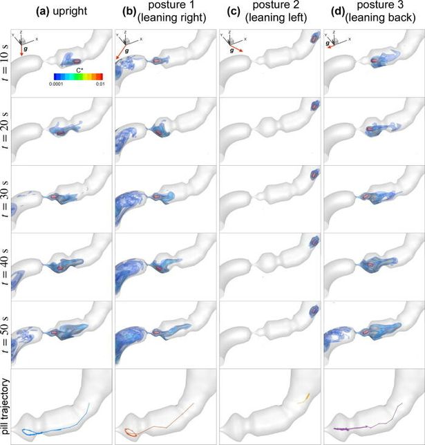 روشی که می تواند تاثیرگذاری قرص های مسکن را تسریع کند روشی که می تواند تاثیرگذاری قرص های مسکن را تسریع کند