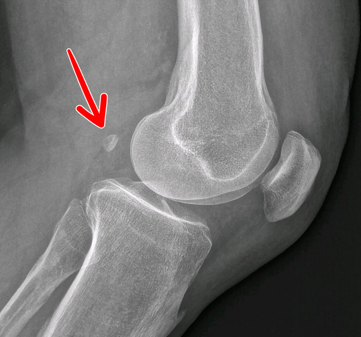 10 راز عجیب درباره بدن انسان که نمی‌ دانستید