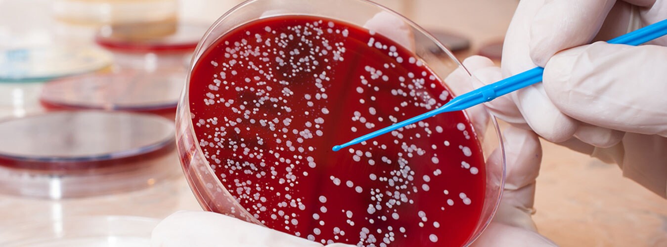 سرطان خون و همه چیز درباره نشانه های آن