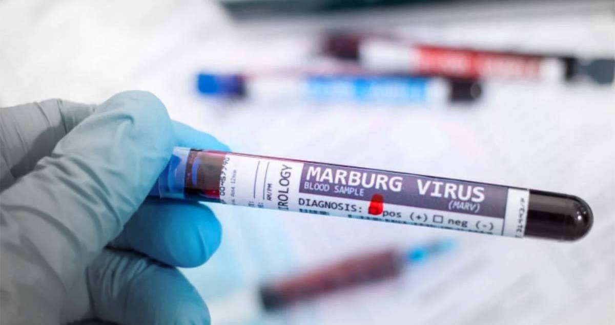 شیوع ویروس ماربورگ در دو کشور آفریقایی