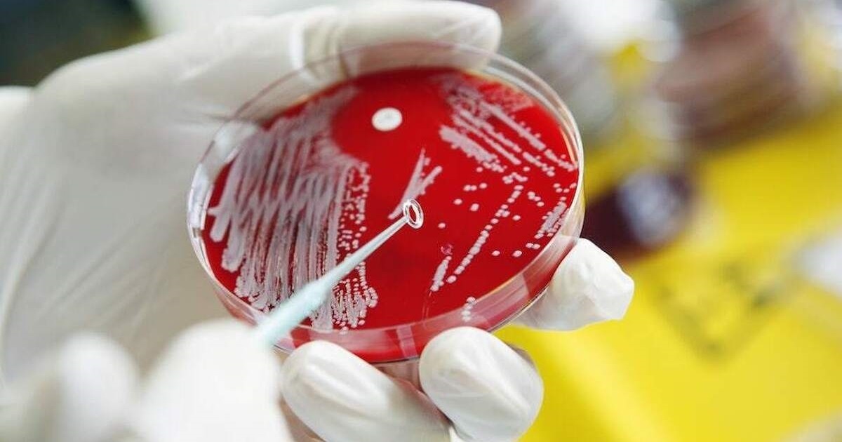 چگونه میکروب‌ها تاریخ را رقم زدند؟