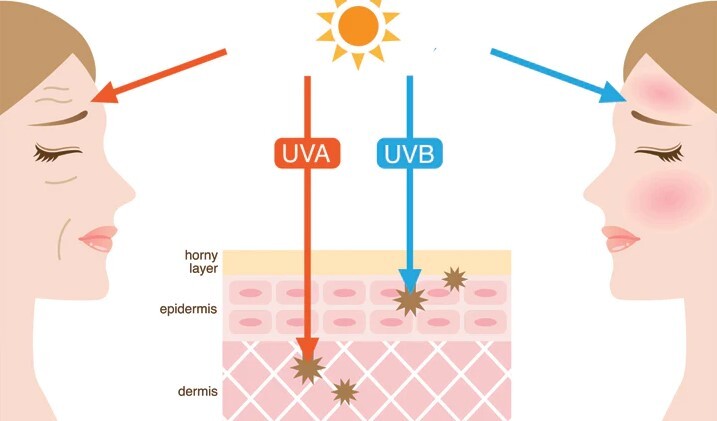 اشعه های مضر برای پوست اشعه های مضر برای پوست