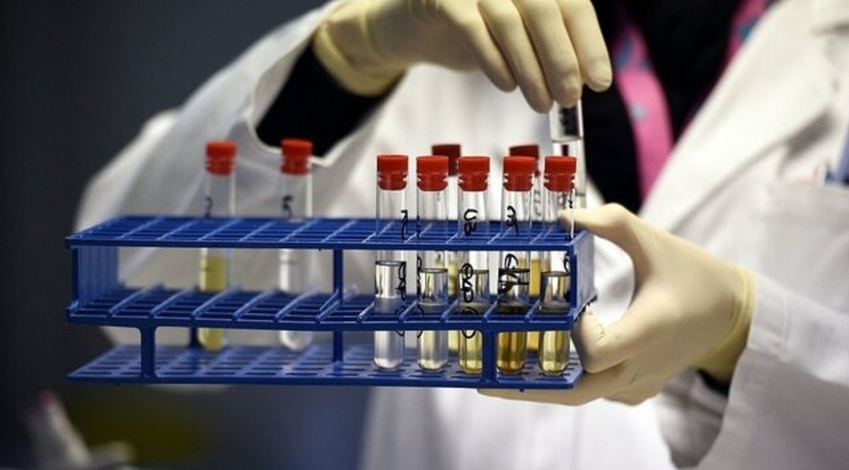 ۶ شش نمونه مثبت دوپینگ در ورزش ایران